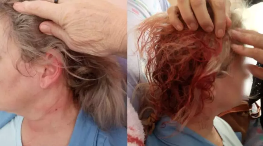 Advogada de Caxias do Sul sofre violenta agressão em condomínio