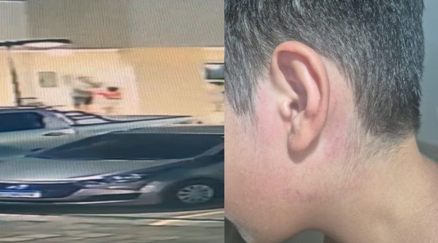 Criança de 8 anos é agredida por oficial de justiça em condomínio de Manaus