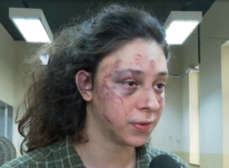 Síndico do prédio presta depoimento e defende porteiro após agressão a Victor Meyniel