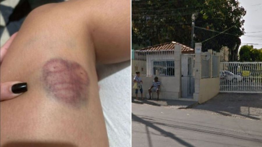 Moradores denunciam ataques de cachorro da raça chow chow em condomínio de Salvador