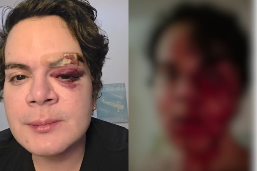 Homem invade apartamento e agride médico com socos e ofensas homofóbicas em condomínio