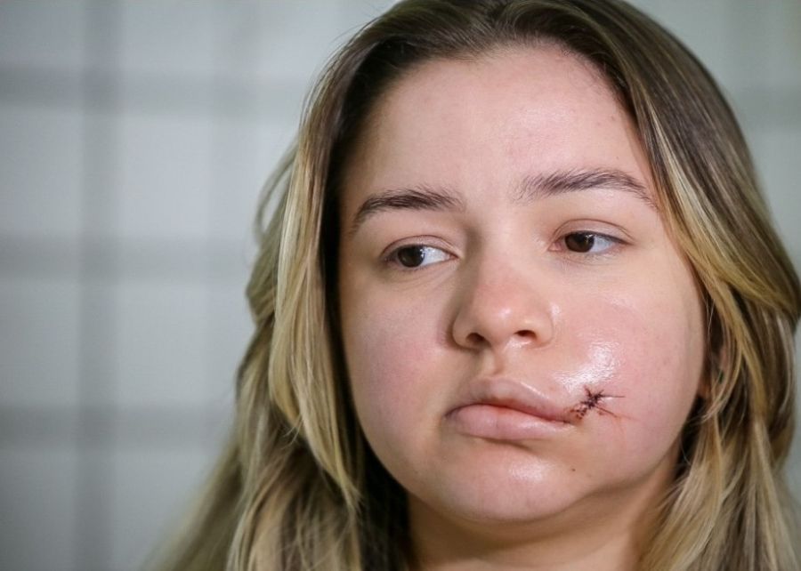 Estudante em Teresina teme após agressão de síndico