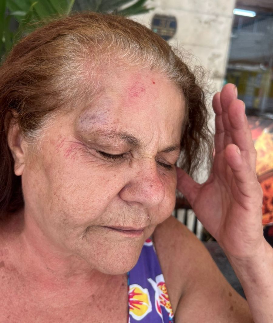 Edifício no recife abalado por agressão e racismo da ex-síndica
