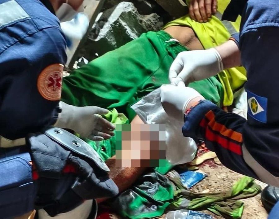 Coletor perde perna após grave acidente durante coleta em condomínio de MT