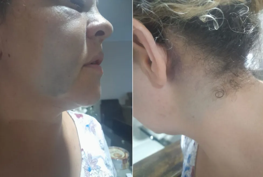 Síndica é agredida por casal de moradores após discussão por regras de condomínio no litoral de SP